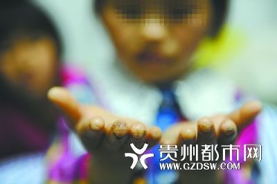 指尖被針扎得傷痕累累。