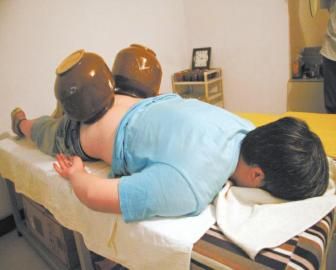 拔泡菜壇子火罐。