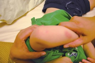 孩子身上有多處明顯傷痕。京華時(shí)報(bào)讀者供圖