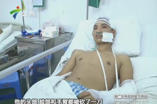 另一名傷者頭部、臉部和手臂都被砍了一刀。(視頻截圖)