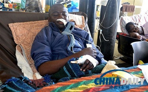 雖然已經(jīng)在醫(yī)院接受了近一個(gè)月的恢復(fù)治療，卡托卡的身體仍然非常虛弱。