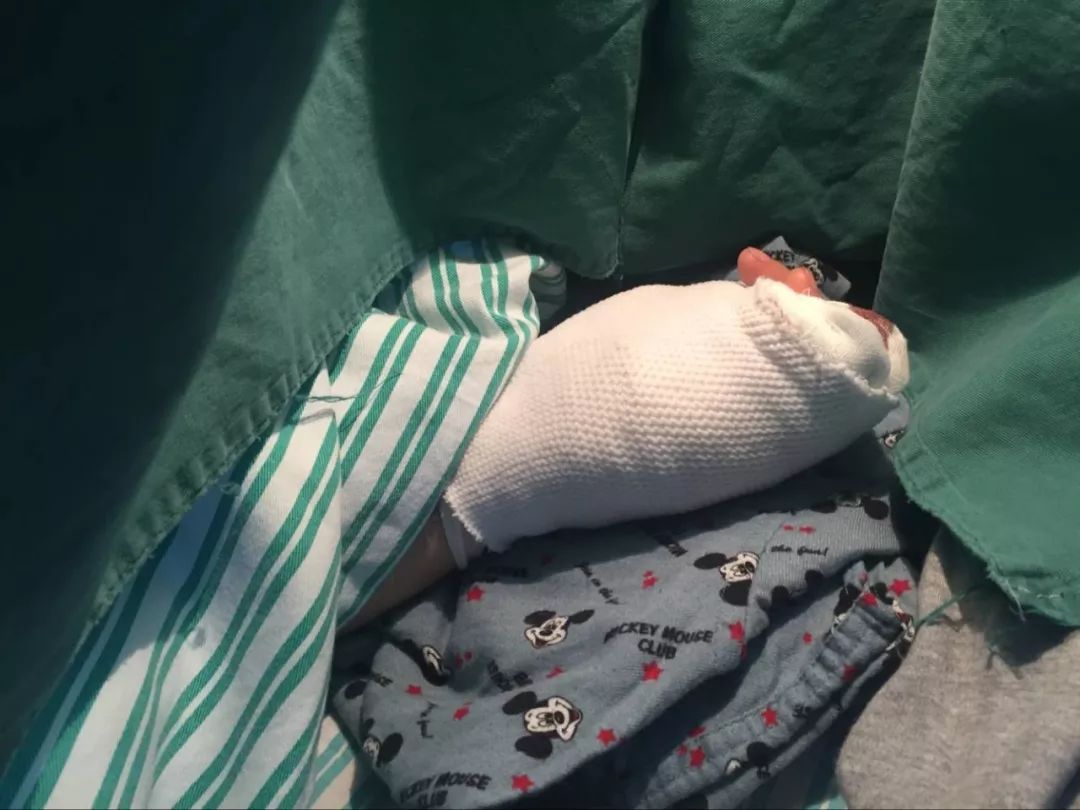 嚇哭！6歲男孩被夾斷手指 罪魁禍?zhǔn)拙故切７? oldsrc=