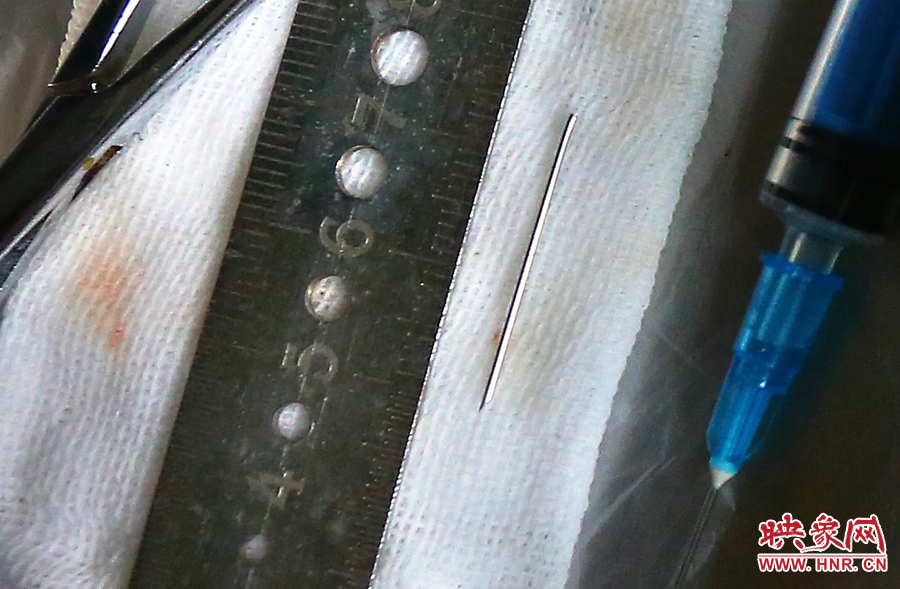 上午11點(diǎn)42分，大龍顱內(nèi)的鋼針被取出