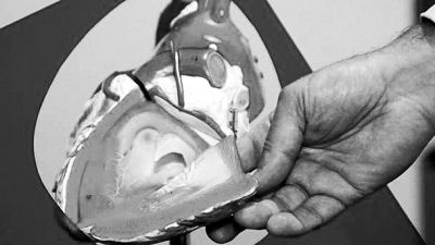 威廉斯領(lǐng)導(dǎo)的研究團(tuán)隊(duì)已經(jīng)利用人體脂肪干細(xì)胞，成功3D打印出心臟血管和心臟瓣膜，待一顆心臟的所有部件打