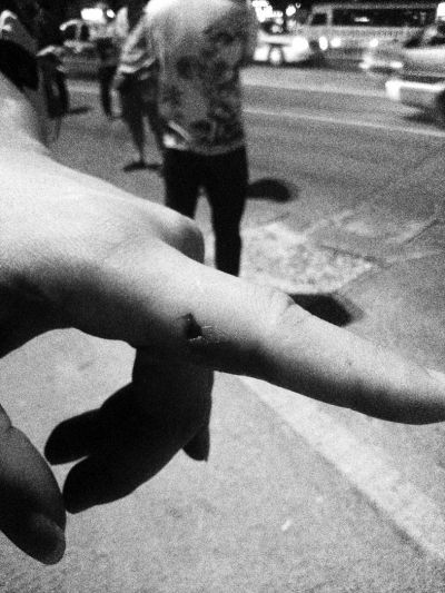 民警食指被咬傷。