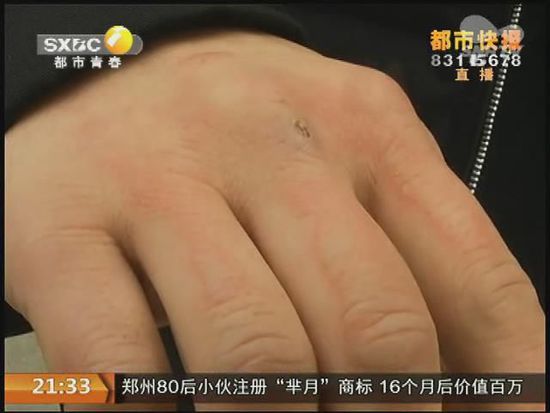 說到這足療拔罐，估計大伙都不陌生，但是想起4號晚上的拔罐的經(jīng)歷，呂先生現(xiàn)在想起來，還心有余悸。