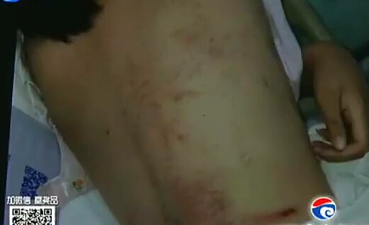 只因沒(méi)給同學(xué)買(mǎi)煙 大一女生被群毆昏迷